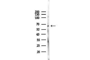 Western blot analysis of lysates from F10-LUC cells(heat-shock,45 min treatment), using Phospho-KLF4 (Ser254) Antibody at 1/1000 dilution.