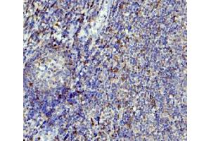 IHC analysis of APOBEC3G using anti-APOBEC3G antibody (ABIN6719444).