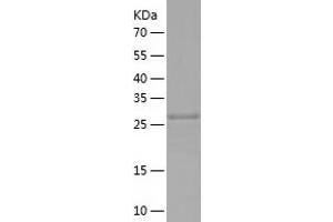 Western Blotting (WB) image for CoA Synthase (COASY) (AA 296-564) protein (His-IF2DI Tag) (ABIN7122414)