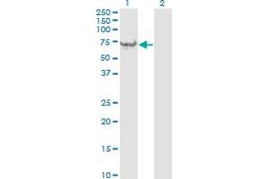 Western Blot analysis of VIM expression in transfected 293T cell line by VIM monoclonal antibody (M01), clone 3E9.