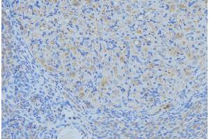 ABIN6276333 at 1/100 staining Human uterus tissue by IHC-P.