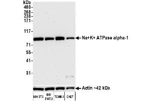 Western Blotting (WB) image for anti-alpha 1 Sodium Potassium Atpase antibody (ABIN7455086) (alpha 1 Sodium Potassium Atpase anticorps)