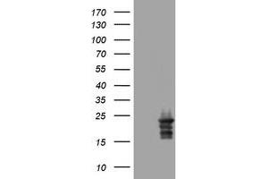 Image no. 3 for anti-Visinin-Like 1 (VSNL1) (AA 2-191) antibody (ABIN1491123) (VSNL1 anticorps  (AA 2-191))