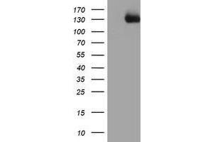 Western Blotting (WB) image for anti-PTK7 Protein tyrosine Kinase 7 (PTK7) antibody (ABIN1497127) (PTK7 anticorps)
