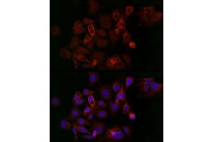 Immunofluorescence analysis of HeLa cells using Ferritin Heavy Chain Rabbit pAb (ABIN3021538, ABIN3021539, ABIN3021540 and ABIN6215218) at dilution of 1:200 (40x lens).