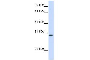 WB Suggested Anti-TNNT3 Antibody Titration:  0.