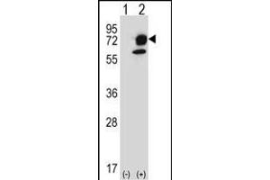 Western blot analysis of ITPKB (arrow) using rabbit polyclonal ITPKB Antibody (R38) (ABIN652430 and ABIN2842237). (ITPKB anticorps  (N-Term))