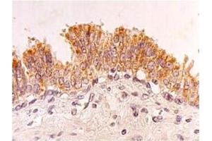 Immunohistochemistry (IHC) image for anti-Four and A Half LIM Domains 2 (FHL2) antibody (ABIN487469) (FHL2 anticorps)