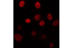 ABIN6274325 staining Hela cells by IF/ICC. (TEF anticorps  (Internal Region))