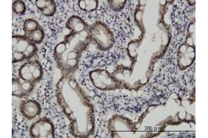 Image no. 2 for anti-Checkpoint with Forkhead and Ring Finger Domains (CHFR) (AA 1-653) antibody (ABIN599268) (CHFR anticorps  (AA 1-653))