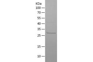 Western Blotting (WB) image for IL2-Inducible T-Cell Kinase (ITK) (AA 147-251) protein (His-IF2DI Tag) (ABIN7123402)