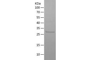 Western Blotting (WB) image for IL2-Inducible T-Cell Kinase (ITK) (AA 147-251) protein (His-IF2DI Tag) (ABIN7123402) (ITK Protein (AA 147-251) (His-IF2DI Tag))