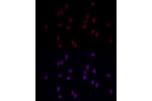 Immunofluorescence analysis of PC-12 cells using METTL14 Rabbit pAb (ABIN6131104, ABIN6143759, ABIN6143760 and ABIN6224625) at dilution of 1:25 (40x lens).