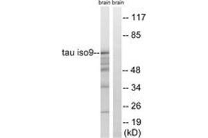 Western blot analysis of extracts from rat brain, using Tau (Ab-717/400) Antibody. (tau anticorps  (AA 366-415))
