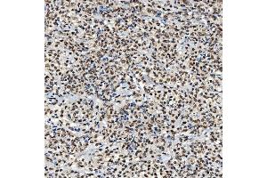 IHC analysis of SNRNP40 using anti-SNRNP40 antibody (ABIN7601719). (SNRNP40 anticorps  (AA 43-357))