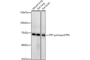 Western blot analysis of extracts of various cell lines, using CTP synthase/CTPS antibody (ABIN7266536) at 1:500 dilution. (CTP Synthase anticorps)