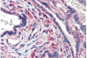 Human Placenta (formalin-fixed, paraffin-embedded) stained with LIN28 antibody ABIN462196 followed by biotinylated goat anti-rabbit IgG secondary antibody ABIN481713, alkaline phosphatase-streptavidin and chromogen.