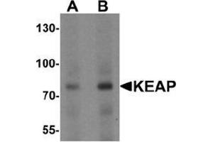 Western blot analysis of KEAP1 in human lung tissue lysate with KEAP1 Antibody  at (A) 1 and (B) 2 μg/ml. (KEAP1 anticorps  (C-Term))