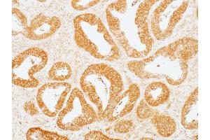 Immunohistochemistry (IHC) image for anti-Mitogen-Activated Protein Kinase Kinase 2 (MAP2K2) (AA 1-50) antibody (ABIN7454013)