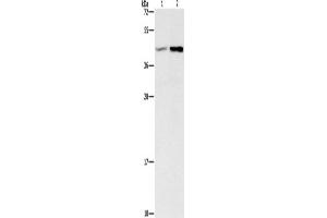 Western Blotting (WB) image for anti-Guanine Nucleotide Binding Protein (G Protein), beta 5 (GNB5) antibody (ABIN5547512) (GNB5 anticorps)