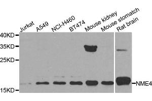 Western blot analysis of extracts of various cell lines, using NME4 antibody. (NME4 anticorps)