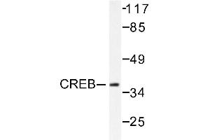 Image no. 1 for anti-cAMP Responsive Element Binding Protein 1 (CREB1) antibody (ABIN265371)