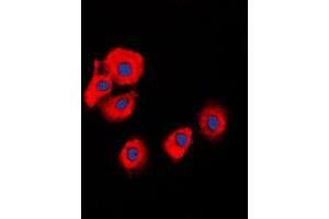 Immunofluorescent analysis of Serpin B5 staining in HeLa cells.