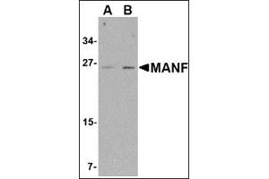 Western blot analysis of MANF in mouse brain tissue lysate with this product at (A) 1 and (B) 2 μg/ml. (MANF anticorps  (C-Term))