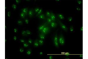 Immunofluorescence of monoclonal antibody to PSMC6 on HeLa cell.