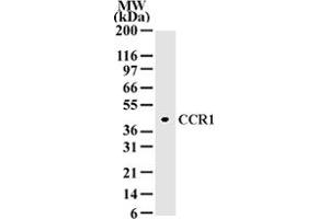 Western blot analysis of 10 ug of total cell lysate from A-375 cells with CCR1 polyclonal antibody  at 2 ug/mL dilution. (CCR1 anticorps  (AA 339-350))