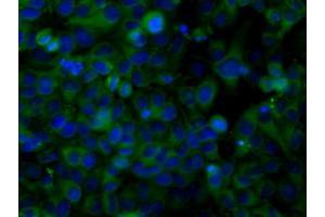 Image no. 2 for anti-Sorting Nexin 9 (SNX9) antibody (ABIN1501045)