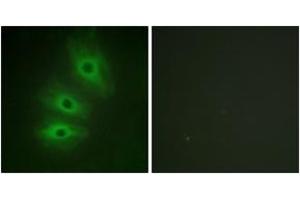 Immunofluorescence analysis of HeLa cells, using ADCY5/6 Antibody. (ADCY5/6 anticorps  (AA 931-980))