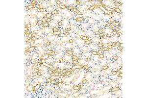 Immunohistochemistry analysis of paraffin-embedded mouse kidney using GBA (ABIN7074062) at dilution of 1: 2000 (GBA anticorps)