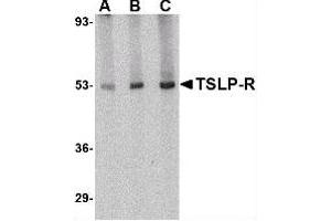 Image no. 1 for anti-Cytokine Receptor-Like Factor 2 (CRLF2) (Center) antibody (ABIN302657) (CRLF2 anticorps  (Center))