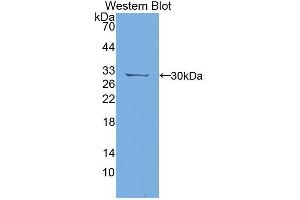 Western blot analysis of the recombinant protein. (PTPRJ anticorps  (AA 1033-1277))
