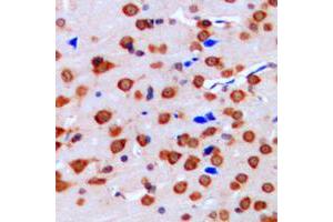 Immunohistochemical analysis of ERK1/2 staining in human brain formalin fixed paraffin embedded tissue section. (ERK1/2 anticorps  (Center))