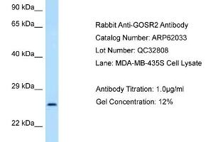 Western Blotting (WB) image for anti-Golgi SNAP Receptor Complex Member 2 (GOSR2) (N-Term) antibody (ABIN2788997) (GOSR2 anticorps  (N-Term))