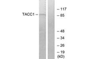 Western blot analysis of extracts from K562 cells, using TACC1 Antibody. (TACC1 anticorps  (AA 11-60))
