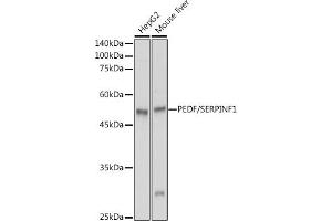 Western blot analysis of extracts of various cell lines, using PEDF/SERPINF1 antibody (ABIN3022372, ABIN3022373, ABIN3022374, ABIN1513515 and ABIN6218766) at 1:1000 dilution.