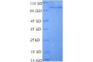 SDS-PAGE (SDS) image for Enolase 1 (ENO1) (AA 2-428), (partial) protein (GST tag) (ABIN5712223)