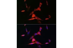 Immunofluorescence analysis of NIH-3T3 cells using RARβ Rabbit mAb (ABIN7269947) at dilution of 1:100 (40x lens). (Retinoic Acid Receptor beta anticorps)