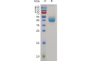 Mouse PSCA Protein, hFc Tag on SDS-PAGE under reducing condition.