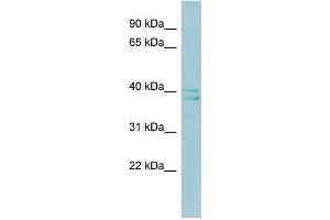 WB Suggested Anti-RAD51AP1 Antibody Titration:  0. (RAD51AP1 anticorps  (Middle Region))