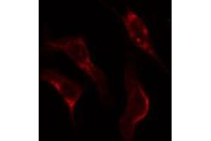 ABIN6274927 staining Hela cells by IF/ICC. (BCAS4 anticorps)