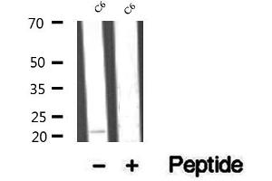 Western blot analysis of extracts of C6 cells, using RAP1B antibody. (RAP1B anticorps  (C-Term))
