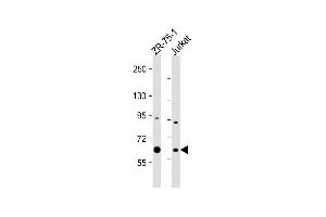 All lanes : Anti-M1D Antibody (Center) at 1:1000 dilution Lane 1: ZR-75-1 whole cell lysate Lane 2: Jurkat whole cell lysate Lysates/proteins at 20 μg per lane. (PPM1D anticorps  (AA 183-212))