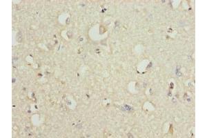 Immunohistochemistry of paraffin-embedded human brain tissue using ABIN7176680 at dilution of 1:100