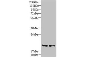 Western blot All lanes: C20orf27 antibody at 6 μg/mL Lane 1: HCT116 whole cell lysate Lane 2: MDA-MB-231 whole cell lysate Secondary Goat polyclonal to rabbit IgG at 1/10000 dilution Predicted band size: 20, 22 kDa Observed band size: 20 kDa (C2orf27A anticorps  (AA 3-174))