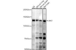 Western blot analysis of extracts of various cell lines, using J antibody (ABIN7268040) at 1:1000 dilution. (JAK2 anticorps)