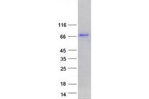 Validation with Western Blot